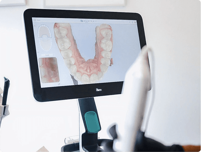 Comfortable 3D Digital Scanning